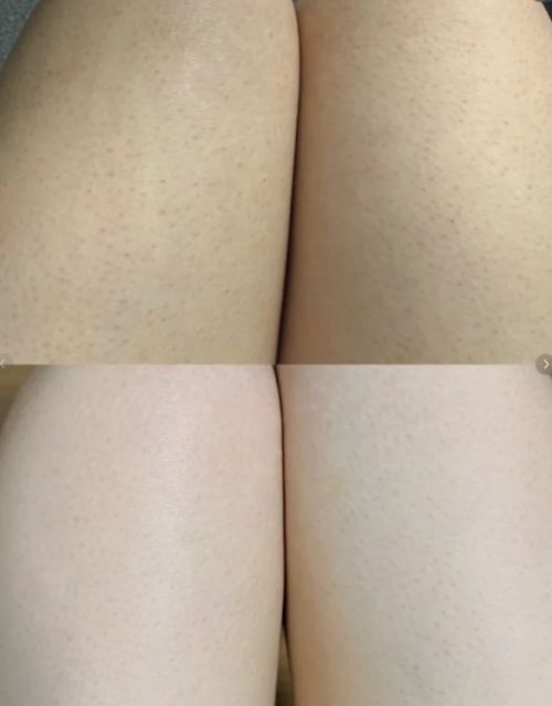 SURRYN素影身体乳锁水修复是冬季肌肤本命AG真人澳门百家家乐身体乳哪个牌子的好用?(图11) SURRYN素影身体乳锁水修复是冬季肌肤本命AG真人澳门百家家乐身体乳哪个牌子的好用?(图11)